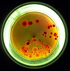 spores in a petri dish
