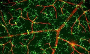 Microglial cells in the brain