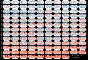 Graphic showing global temperature rise 1850-2017