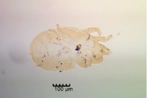 A mite fragment identified by the Reading scientists which helped trace the stolen cash to Thailand